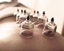 Comprehensive Cupping Therapy | May 6-7, 2023: Deposit